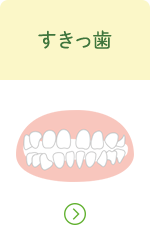 すきっ歯へのリンクボタン