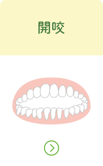 開咬へのリンクボタン