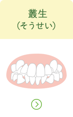 叢生へのリンクボタン