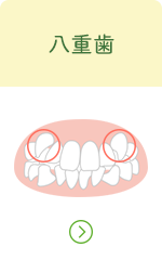 八重歯へのリンクボタン